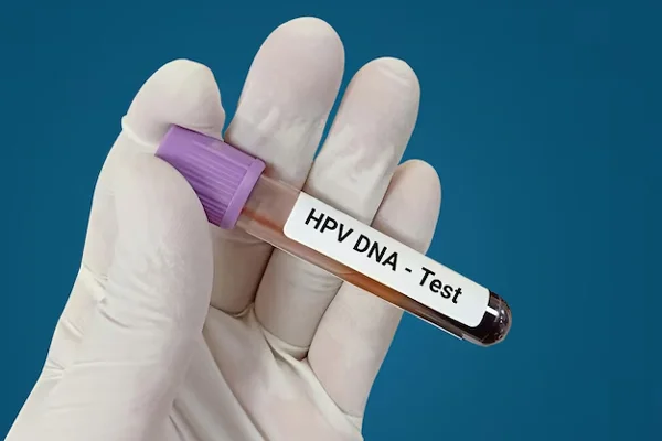 HPV DNA Testing